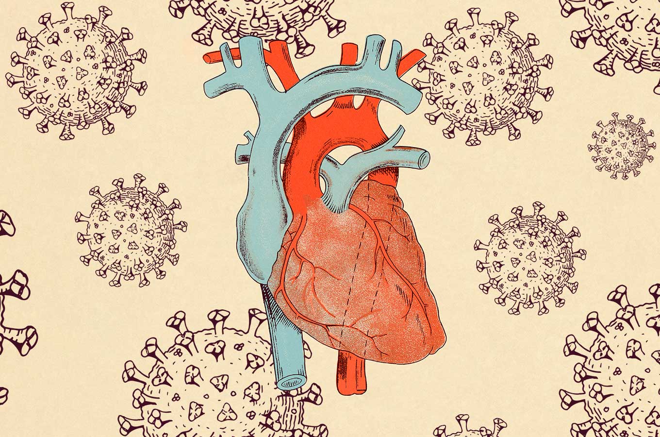 POTS or Long COVID? How to tell the difference, Brain, COVID, Heart