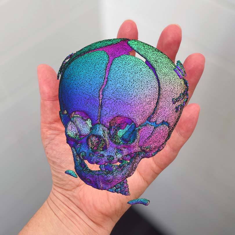 A hand "holding" a 3D model of an infant skull in augmented reality.