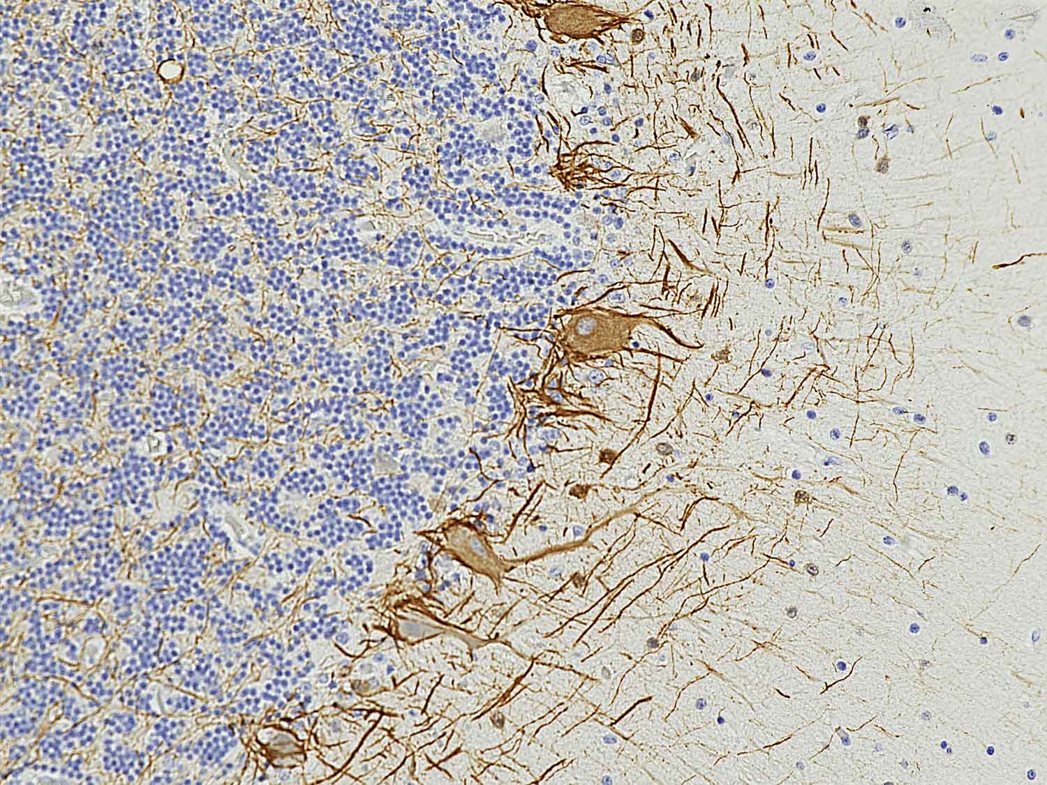 A microscopic image showing a neurofilament light chain.
