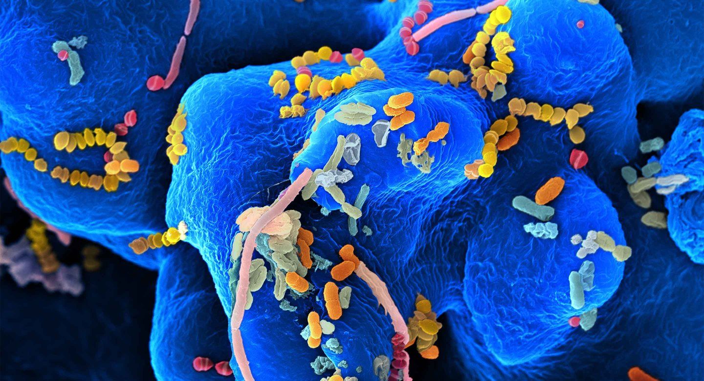 Hand-colored image from a scanning electron microscope of oral bacteria.