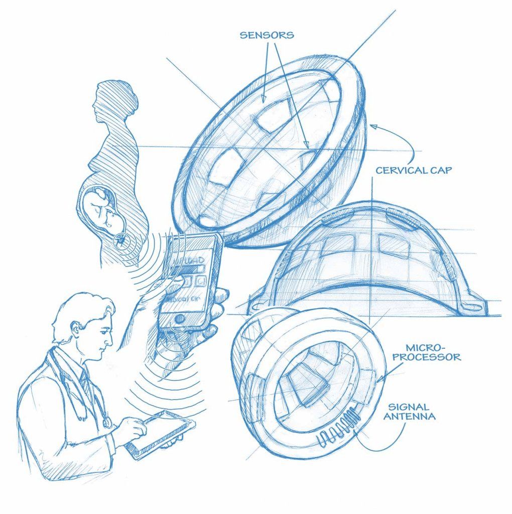 Technical drawing showing the BirthAlert system.