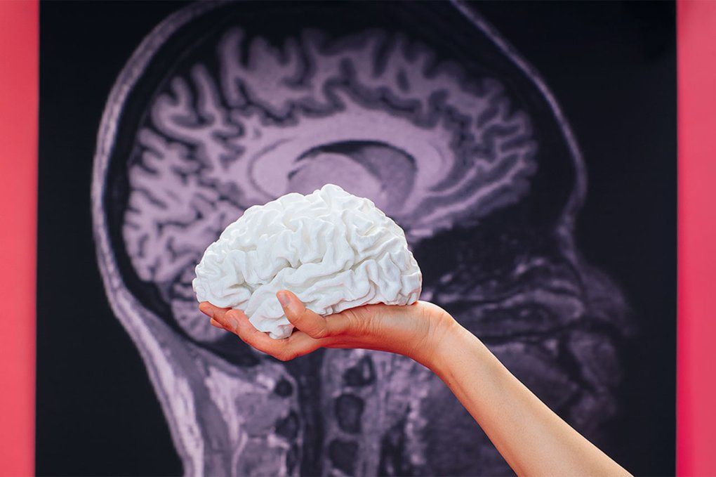 A hand holds up a white model of a brain in front a an image of a MRI scan of a human brain.