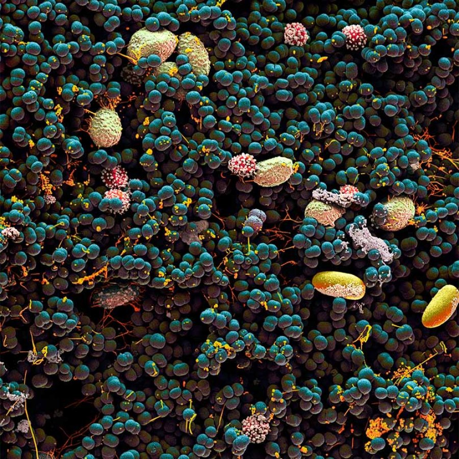 A hand-colored image from a scanning electron microscope of belly button bacteria.