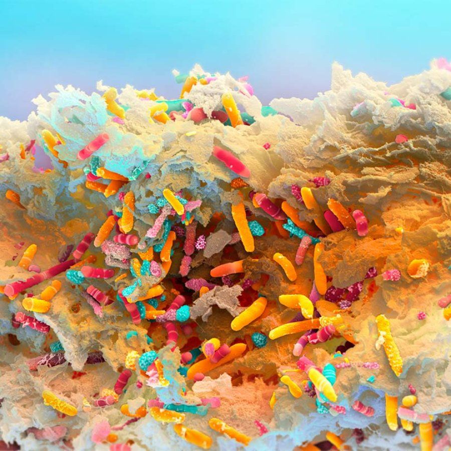 Artistically colored microscope image of the gut microbiome of an infant one month after birth.