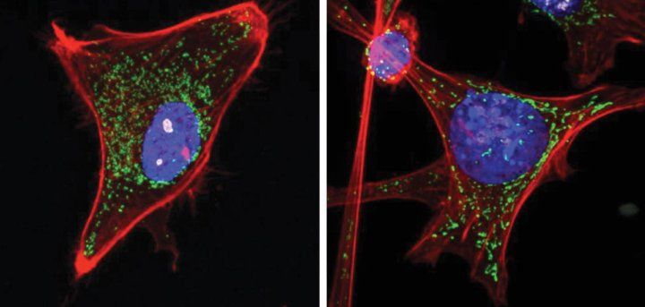 Two microscopic images of mouse connective tissue.