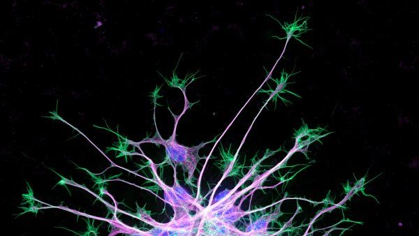 Microscopic image of neuron cytoskeleton