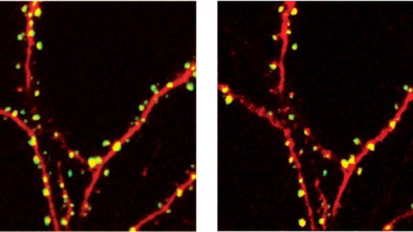 microscope image of brain circuits