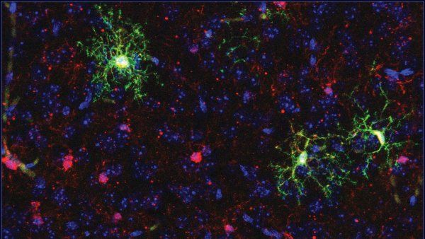 Microsopic image of stem cells transplanted in utero in mice