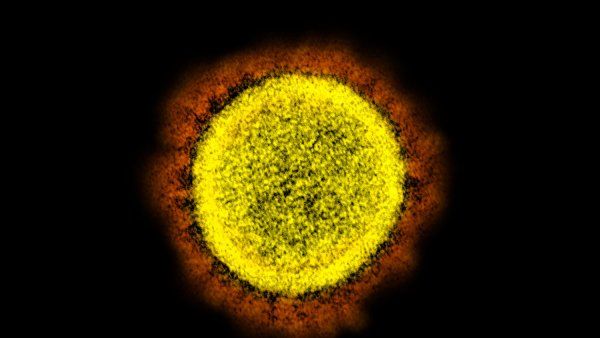 Microscopic image of a single coronavirus particle