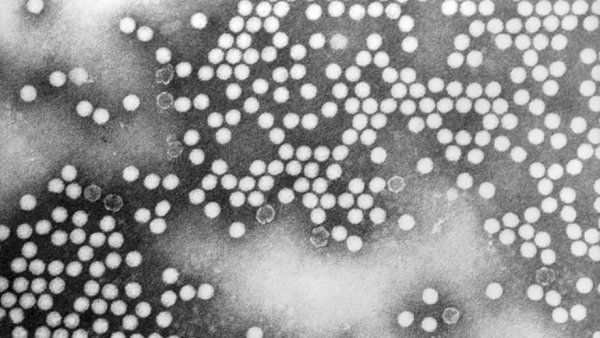 Transmission electron micrograph of poliovirus type 1