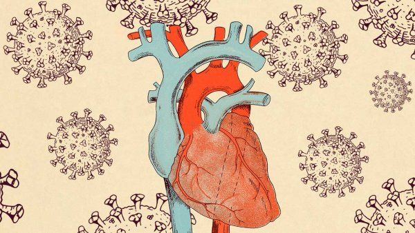 Vintage style illustration of a human heart with SARS-CoV-2 cells floating around it.