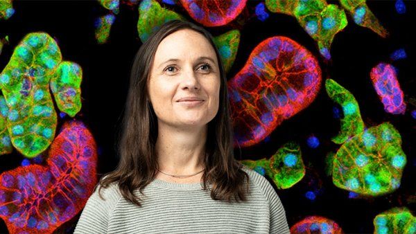 Portrait of Sarah Knox in front of a background of colorful microscopic imagery of acini and ducts in a mouse submandibular salivary gland.