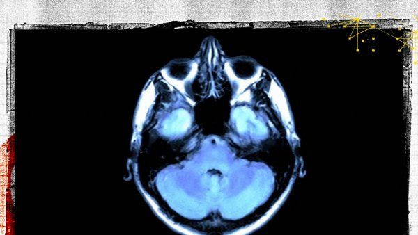 Photo of brain imaging.