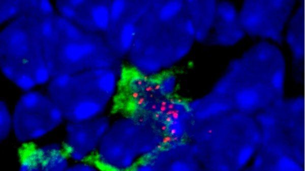 Microscopic image of eTAC cells