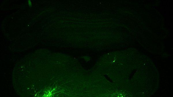 Microscopic image of neurons (green) in the brainstem that coordinate vocalization and breathing