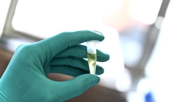 Hand with medical glove holding a vial of fluid