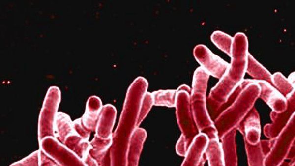 Red-colored, rod shaped, Mycobacterium tuberculosis bacteria, which cause tuberculosis (TB) in human beings.