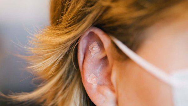 Acupressure seeds are small seeds attached to an adhesive strip that can be used to stimulate acupoints, especially on the ear, to support non-pharmacological symptom management.