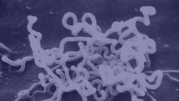 A scanning electron microscopic image of a cluster of sprial-shaped Treponema pallidum bacteria, which cause syphilis.