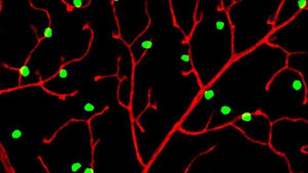 A microscopic image showing neurons (green) in the retina of the eye making blood vessels (red).