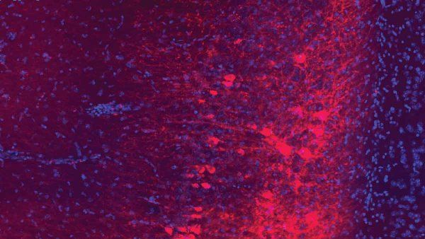 A microscopic image of neurons that connect the hippocamus and amygdala in a mouse's brain. The neurons are dyed red and purple