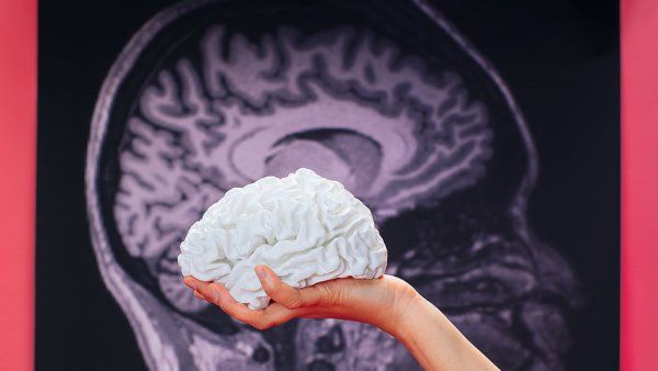 A hand holds up a white model of a brain in front a an image of a MRI scan of a human brain.