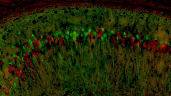 A microscopic image of neurons expressing the mother's X chromosomes in green, and the father’s X chromosomes in red.