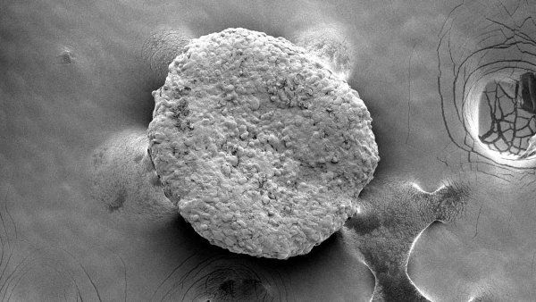 A greyscale microscopic image of a fat organoid cell.