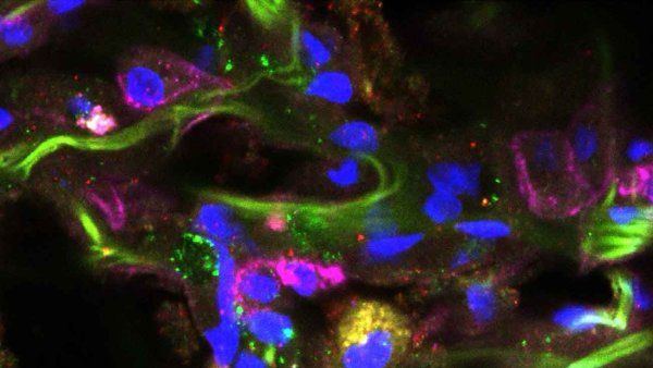 A microscopic image of a hematopoeitic stem cell from a human lung sample.