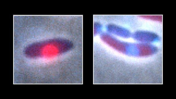 Microscopic images of bacteria infected with PhiKZ jumbo phages, which are shown as bright dots within the pill-shaped bacteria.