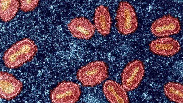 Colorized transmission electron micrograph of mpox virus particles (red/yellow) found within an infected cell (blue).