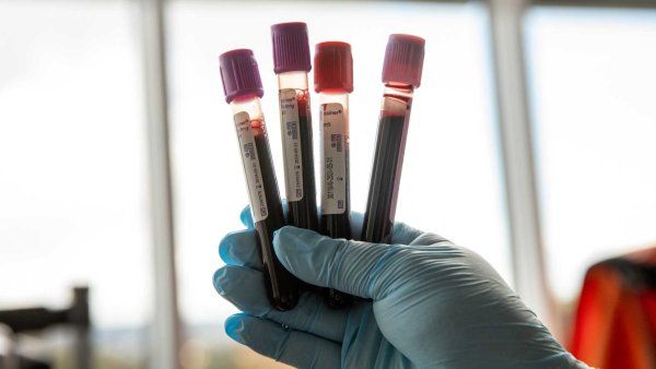 A clinician's hand holds vials with blood samples.