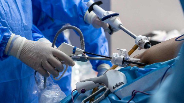 A surgeon performs laparoscopic bariatric surgery.