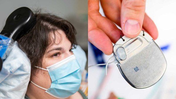 A two-part image showing a patient wearing a head-mounted medical device on the left, and a close-up of a hand holding a small, metallic deep brain stimulation (DBS) implant on the right.