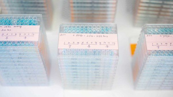 Well plates in a laboratory with genetic information.