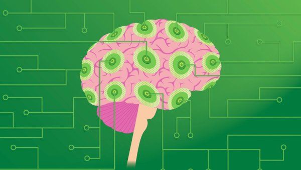 A stylized illustration of a human brain with a pink and green circuit-like design.