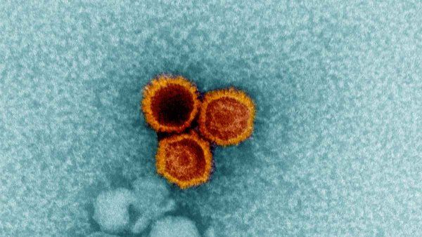 An electron micrograph showing three Epstein-Barr virus (EBV) particles colorized in red and orange.