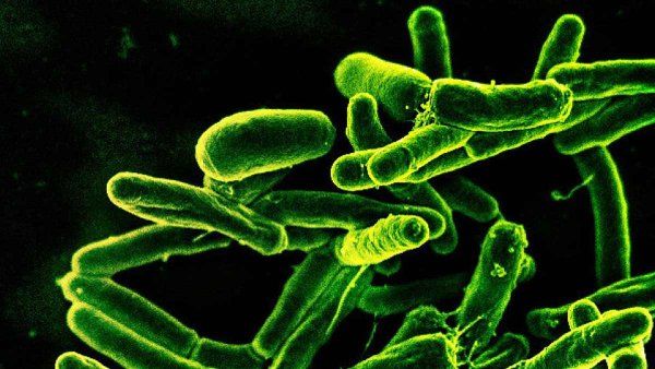 Scanning electron micrograph of Mycobacterium tuberculosis bacteria, which cause tuberculosis.