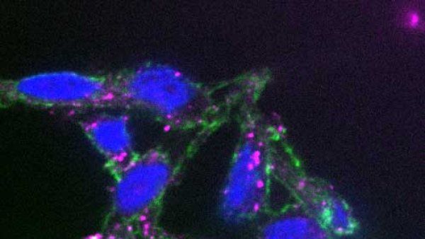 A fluorescent microscope image of cancer cells featuring blue DNA, green structural proteins, and pink SRC proteins on the cell surfaces.