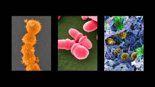 Microscopic visualization of diverse microbial life, featuring colorful, textured bacteria including red rod-shaped clusters, golden spheres, and purple filaments.