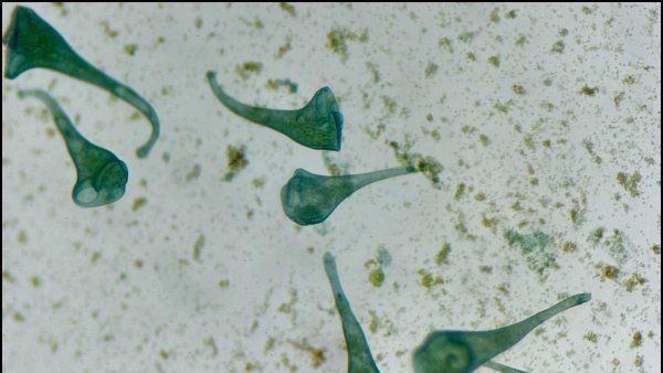 Microscopic image showing the trumpted-shaped single-cell organism, stentor, in its normal state before receiving stimluation.
