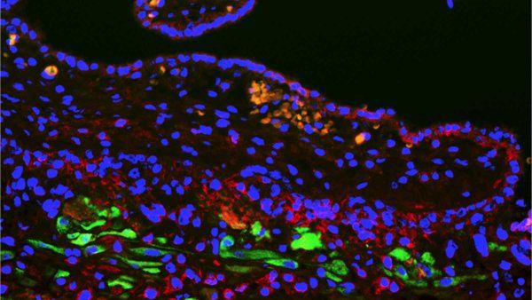 A microscopic close-up of cells connecting mother and fetus, including a newly identified type linked to pregnancy outcomes.