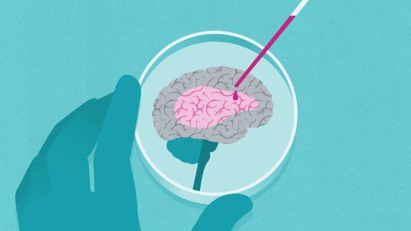 A conceptual illustration showing a hand administering a liquid medication to a brain on a petri dish, signaling to treatments of brain disease and mental health.