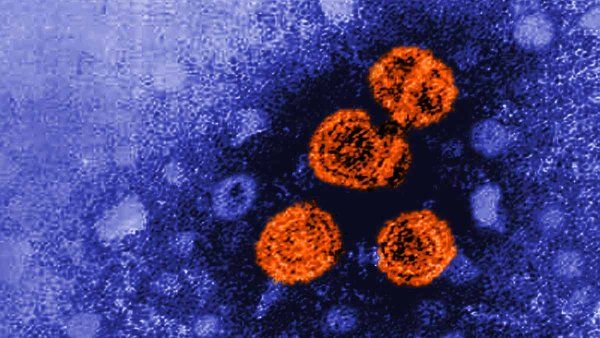 Transmission lectron microscopic image showing hepatitis B virus particles, which are round orange viroids.