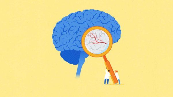 A conceptual illustration showing two scientists holding up a large magnifying glass to a brain, signaling to neurological study.