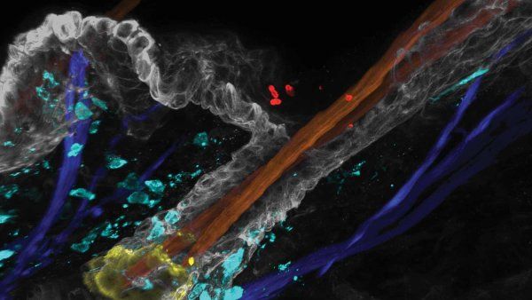Fluorescent microscopy image of a hair follicle showing Candida auris cells and immune cells in the surrounding skin.