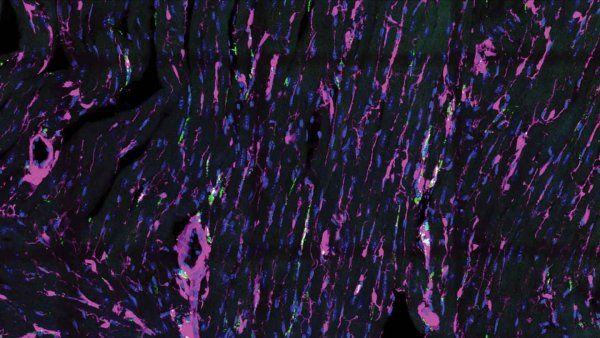 Fluorescent microscopy image of heart muscle showing fibroblasts in magenta and macrophages in green.