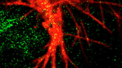 Cytonemes_Kornberg_Lab.png