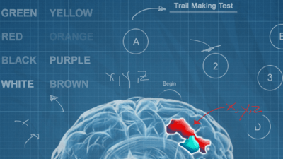 The dorsolateral prefrontal cortex, depicted in blue and red, is larger and linked with better function in those who carry one copy of the KLOTHO gene variant..png