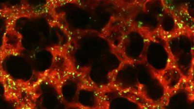 blood_formation_in_the_lungs.jpg